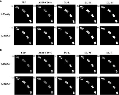 Deep-learning image reconstruction for image quality evaluation and accurate bone mineral density measurement on quantitative CT: A phantom-patient study